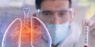 Patru cazuri noi de COVID-19 în Vrancea, în ultimele 24 de ore