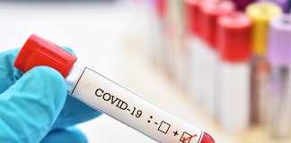 Coronavirus, ora 13.00: date în scădere, în ultimele 24 de ore – 164 cazuri noi, sub 400 de pacienți în secțiile ATI