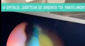 VIDEO Intervenție complicată, finalizată cu succes, la Spitalul Județean din Focșani
