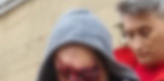 ULTIMA ORĂ Bărbat atacat de urs la Tulnici