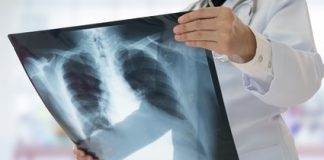 Sprijin pentru 40 de bolnavi de tuberculoză din Vrancea