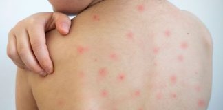 De ce a revenit epidemia de rujeolă. Cum îți protejezi copilul