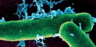 Focar de antrax în comuna Ciorăști