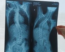 „Mamă, am luptat degeaba?” Întrebarea unui copil de 15 ani care nu mai are timp să aștepte 2 umanitar mihai