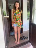 „Vreau doar să nu mă mai doară.” Diana are 12 ani și luptă cu o deformare severă a coloanei vertebrale 3 umanitar diana 2