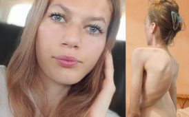 Umanitar: La 16 ani, Denisa are nevoie de ajutor pentru operația care îi poate reda șansa la o viață normală 3 denisa umanitar 1