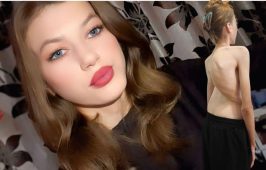 Umanitar: La 16 ani, Denisa are nevoie de ajutor pentru operația care îi poate reda șansa la o viață normală 1 denisa umanitar